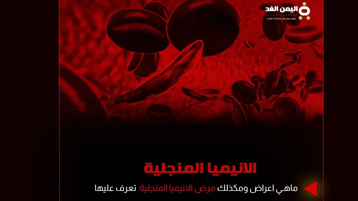 الانيميا المنجلية