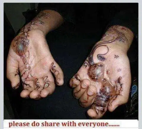 الحذر من إستخدام الحناء الصيني : اعراض مخيفه بسبب الحنة الصينية 2 20 04 18 877338963 | الحذر من إستخدام الحناء الصيني : اعراض مخيفه بسبب الحنة الصينية