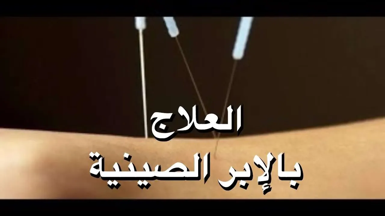 سارة متضرره في كوريا يوتيوبر مغربية  مخاطر الإبر الصينية