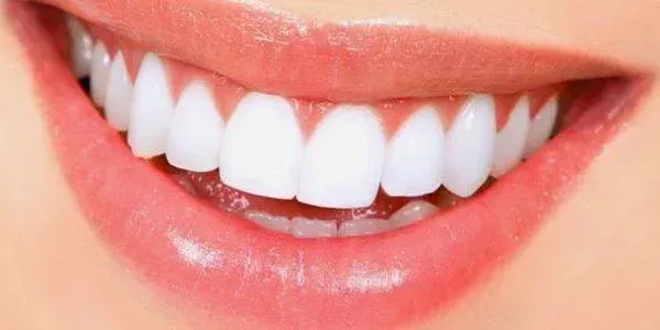 4 وصفات طبيعية لتبييض الأسنان والقضاء على التسوس..