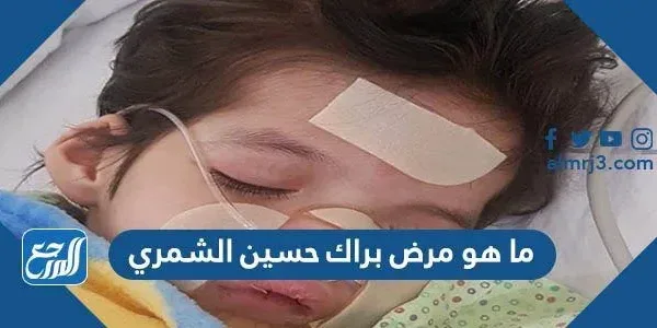 ما هو مرض براك حسين الشمري