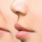 تسمين الوجه 730x370 1