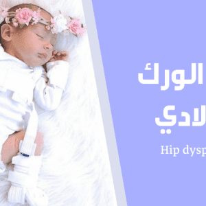 خلع الورك الولادي؛ الأسباب وطرق العلاج