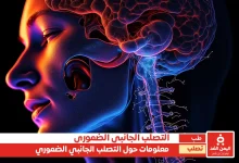 التصلب الجانبي الضموري