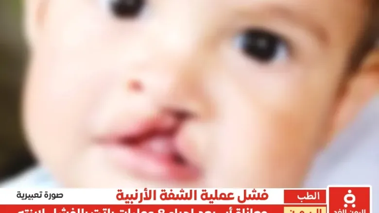 معاناة مواطن في عدن بسبب الفشل الطبي وإجراء 8 عمليات فاشلة لإبنته "الشفة الأرنبية"