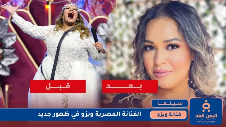 صور الفنانة ويزو