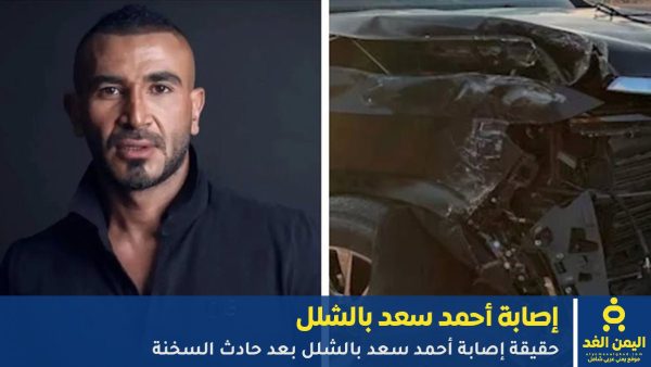 حقيقة إصابة أحمد سعد بالشلل بعد حادث السخنة