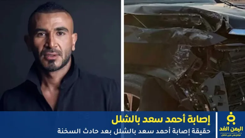 حقيقة إصابة أحمد سعد بالشلل بعد حادث السخنة